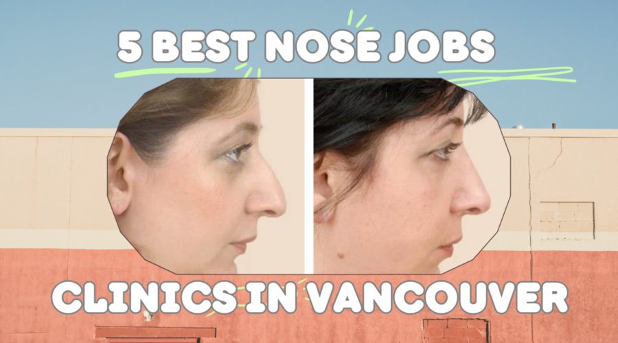 5 Best Nose Jobs Clinics in Vancouver