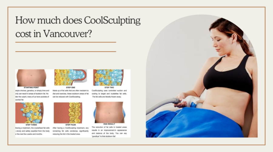 How much does CoolSculpting cost in Vancouver?