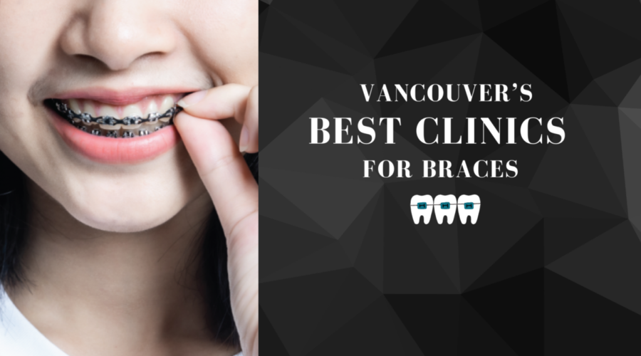 Best Clinics For Braces in Vancouver